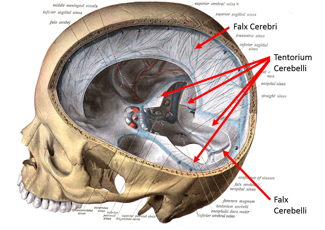Диафрагма черепа. Falx Cerebri серп большого мозга. Намет мозжечка tentorium cerebelli.