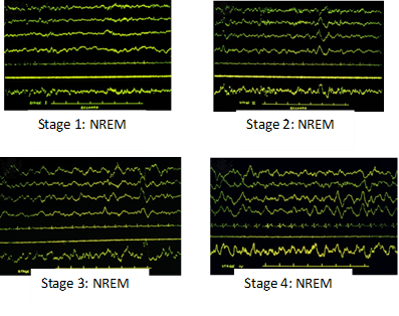 Higher Brain Functions: The EEG and Sleep